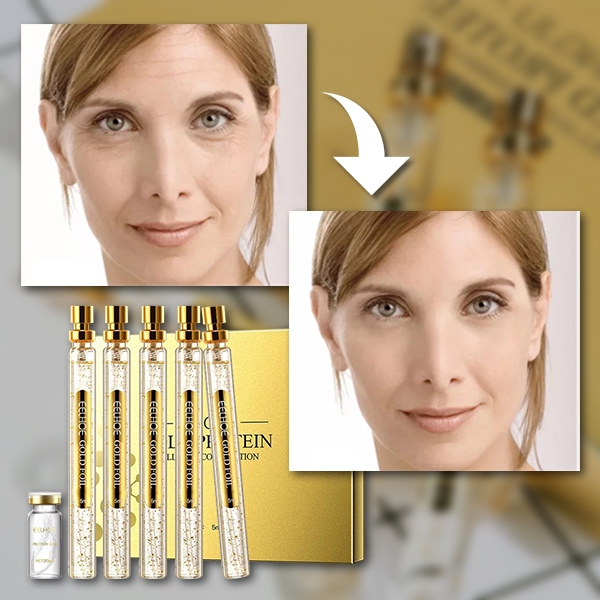 Σετ ορών για πρωτεϊνική περιποίηση δέρματος | PROLIFT