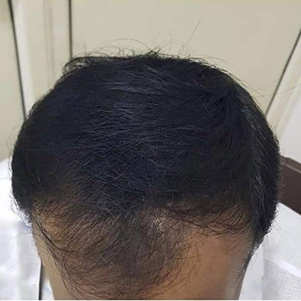 Μικροΐνες Σπρέι Μαλλιών | HAIRBUILD